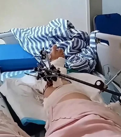 পায়ে অপারেশন করা হয়েছে পেং হুইফাং-এর। ছবি: সংগৃহীত