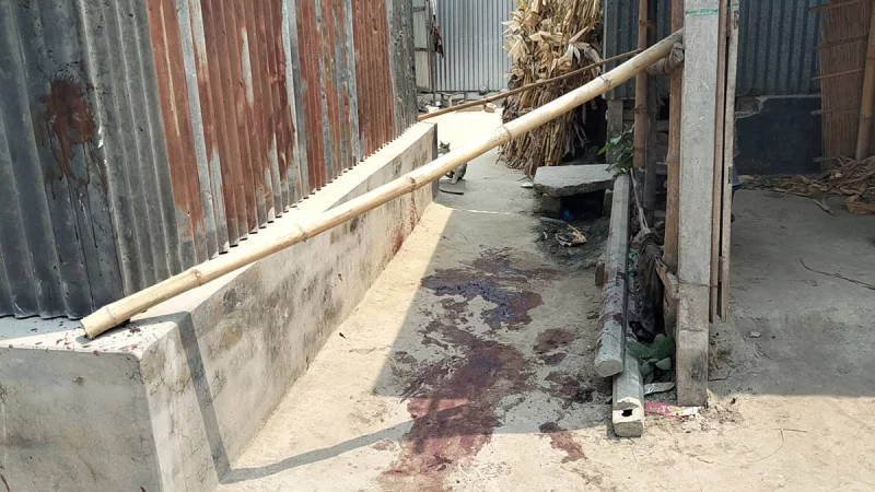 চরভদ্রাসনে যুবকের হাত-পা বিচ্ছিন্নের ঘটনায় মামলা, অবস্থা আশঙ্কাজনক